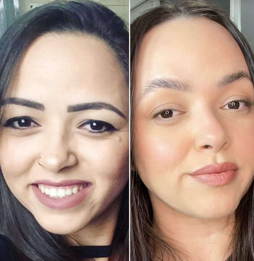 Resultado Método Sobrancelha dos Sonhos — Antes e Depois