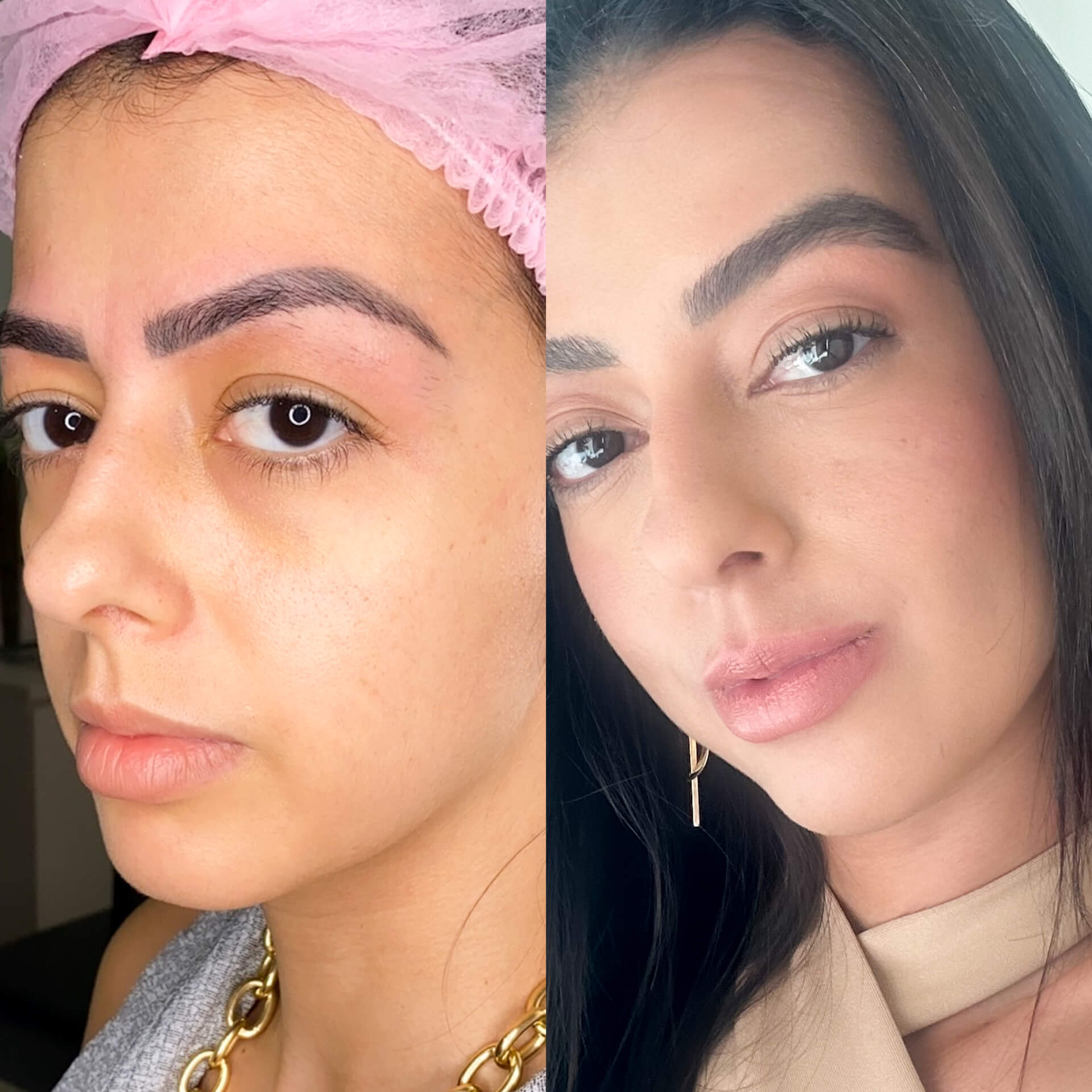 Resultado Método Sobrancelha dos Sonhos